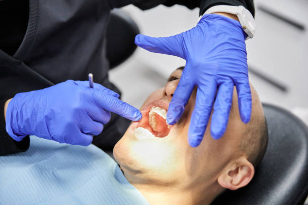 Best Emergency Wisdom Tooth Extraction in Pinconning, MI